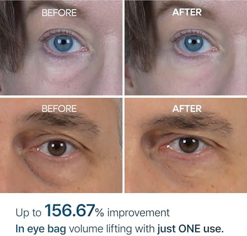 Dr.Melaxin Eyephalt Eyebag Cream