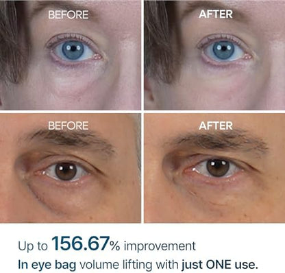 Dr.Melaxin Eyephalt Eyebag Cream