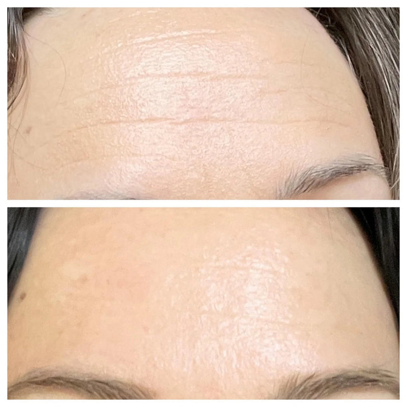 Incredible transformation