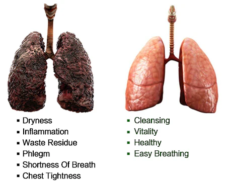BREATHE-RIGHT ORGANIC HERBAL ORAL LUNG SPRAY: POWERFUL LUNG SUPPORT CLEANSE & REPAIR.